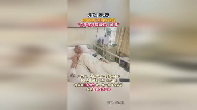 辐射危机下的年轻人生死抉择，六日噩梦与截肢的严峻考验